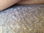 skin inglés